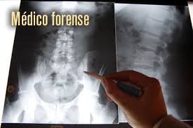 POSIBILIDAD DE QUE LOS MÉDICOS FORENSES PUEDAN SEGUIR EMITIENDO INFORMES A SOLICITUD DEL&nbsp;INTERESADO